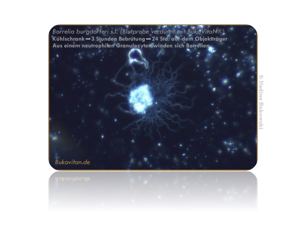 Spirochäten BukoVitaN®