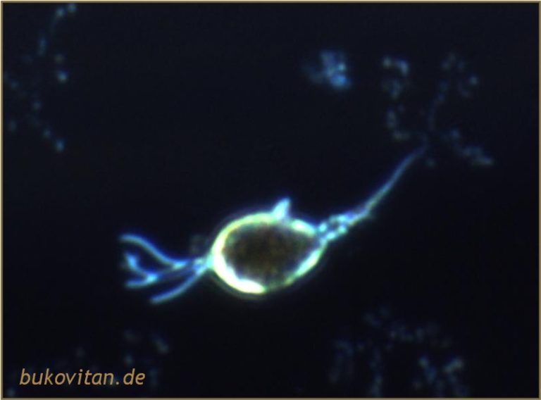 Trichomonaden BukoVitaN®