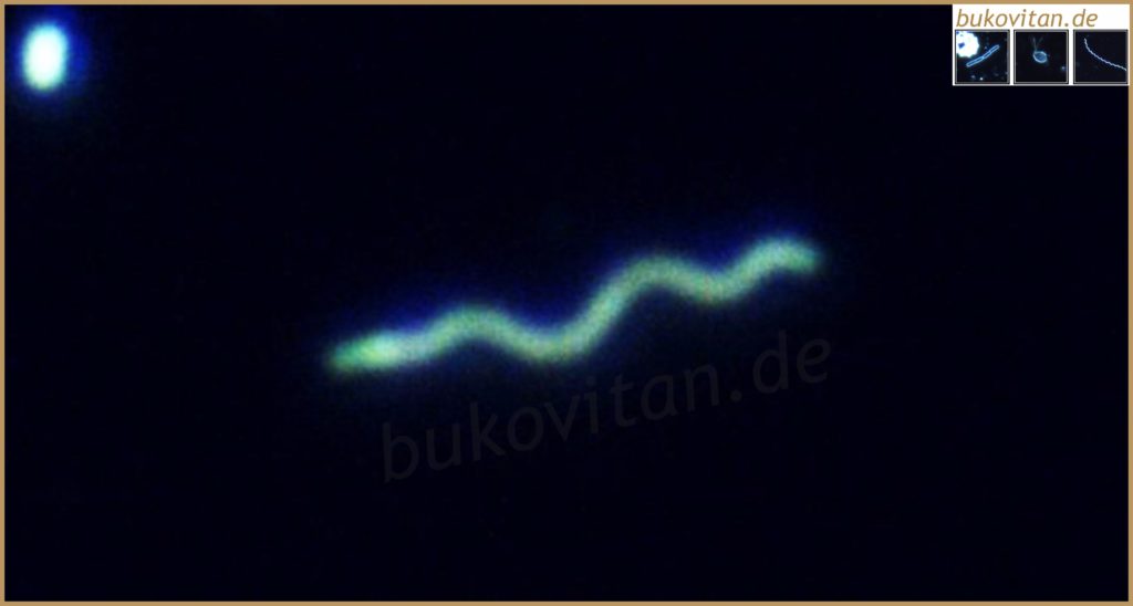 Borrelien und der neue Name „Borreliella“ BukoVitaN®