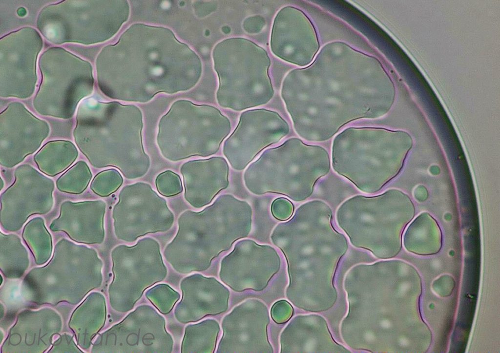 Borreliose Co.Infektionen BukoVitaN®