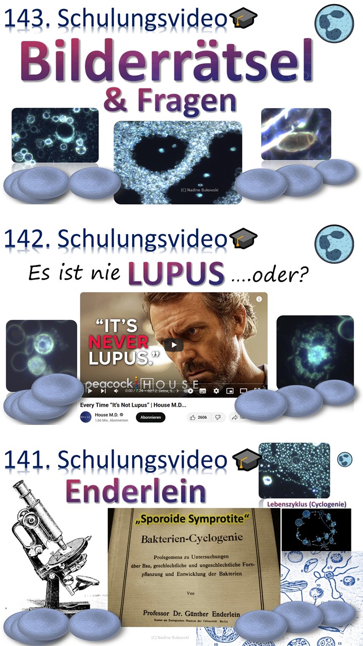 Lupus